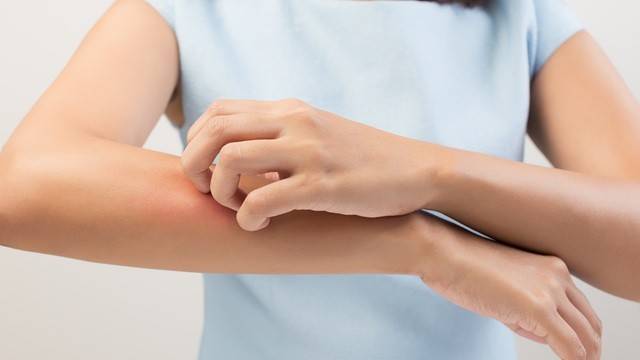 피부를 긁은 자국이 그대로 부풀어 오른다면 피부묘기증 때문일 수 있다|출처: 게티이미지뱅크
