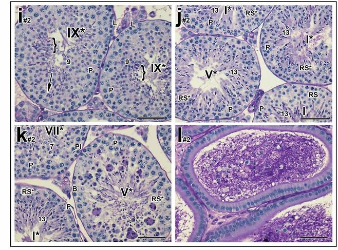 수컷 생쥐에 하루 20mg의 YCT-529를 투여한 후 정자 상태를 관찰한 모습. /사진=네이처 커뮤니케이션