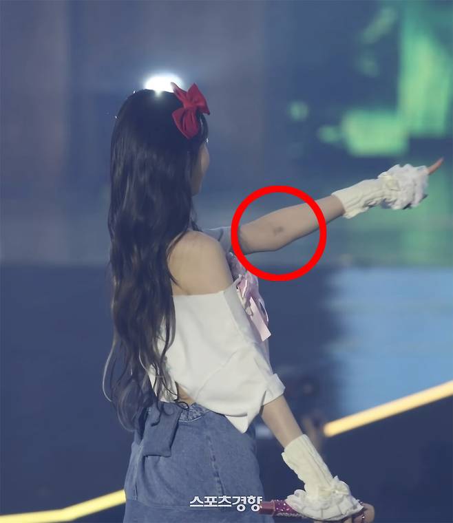 최근 팬 콘서트 무대에서 링거 흔적이 포착된 아이브 멤버 장원영. 온라인커뮤니티 캡처