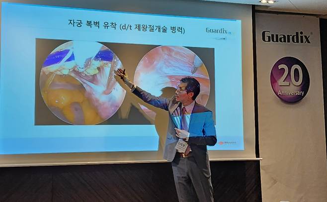 제네웰이 22일 서울 중구 더플라자에서 진행한 기자간담회에서 김태중 삼성서울병원 산부인과 교수가 제왕절개술을 받은 여성에게서 자궁 복벽이 유착된 사례, 유착방지제를 뿌린 사례를 소개하고 있다./사진=정심교 기자