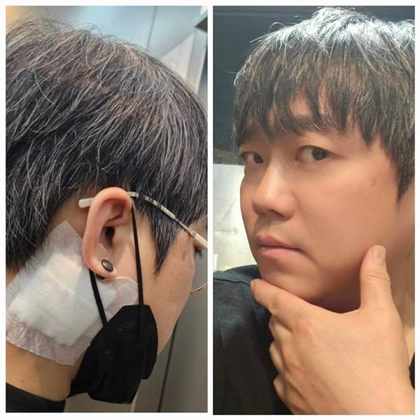 송백경은 지난 22일 자신의 SNS를 통해 “내 몸에 남아있는 마지막 연예인병 흔적인 타투를 오늘 처음으로 지웠다”고 밝혔다. 사진=SNS