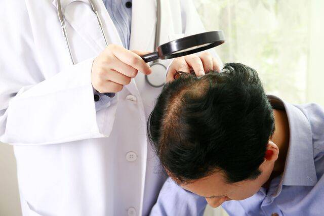 탈모 사진. 클립아트코리아 제공