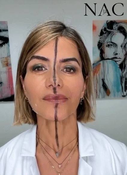 미국의 한 피부과 의사가 얼굴의 오른쪽에만(의사 기준) 보톡스를 주사한 모습. 시술한 쪽의 주름이 완화된 것을 볼 수 있다./사진=뉴욕포스트