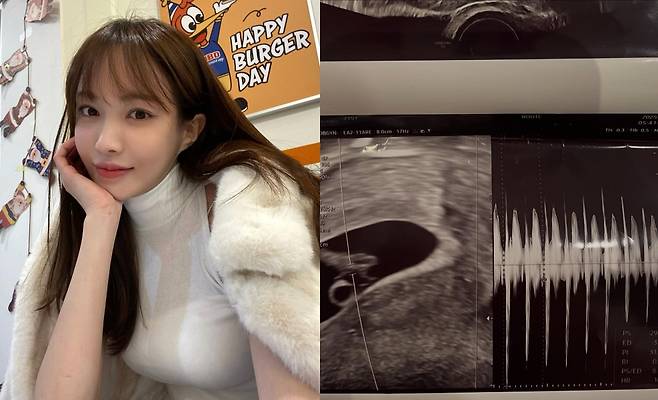 서민재 / 사진=서민재 인스타그램