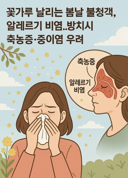꽃가루, 축농증, 알레르기, 비염 등의 키워드로 챗GPT가 생성한 이미지