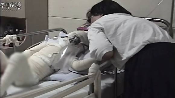 대구 황산테러 사건 피해자 태완이. KBS ‘추적 60분’ 유튜브 화면 캡처