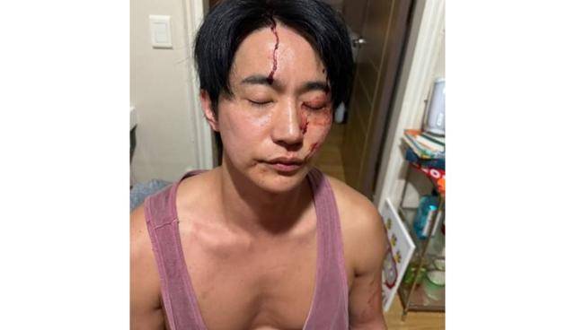 뮤지컬 배우 전호준이 전 연인의 데이트 폭행 폭로에 대해 반박했다. 전호준 SNS