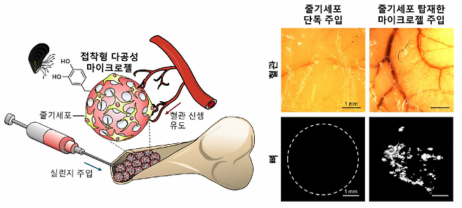 홍합의 접착 원리를 응용한 주사형 줄기세포 치료제의 원리를 나타낸 모식도. 포스텍 제공