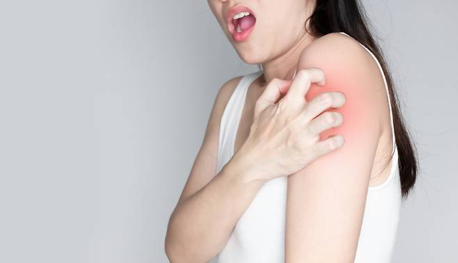 국내 청소년의 35%가 알레르기 질환을 앓고 있으며, 경제수준과 스트레스·수면시간 등이 연관이 있는 것으로 조사됐다. 게티이미지뱅크