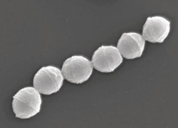 ‘연쇄상구균 독성쇼크중후군’의 원인이 되는 A군 연쇄상구균. 일본 국립감염병연구소