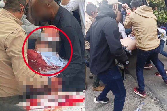 7일(현지시간) 콜롬비아 보고타에서 총격을 받은 미겔 우리베 투르바이(39) 콜롬비아 상원의원이 구급차로 옮겨지고 있다. 엑스 캡처