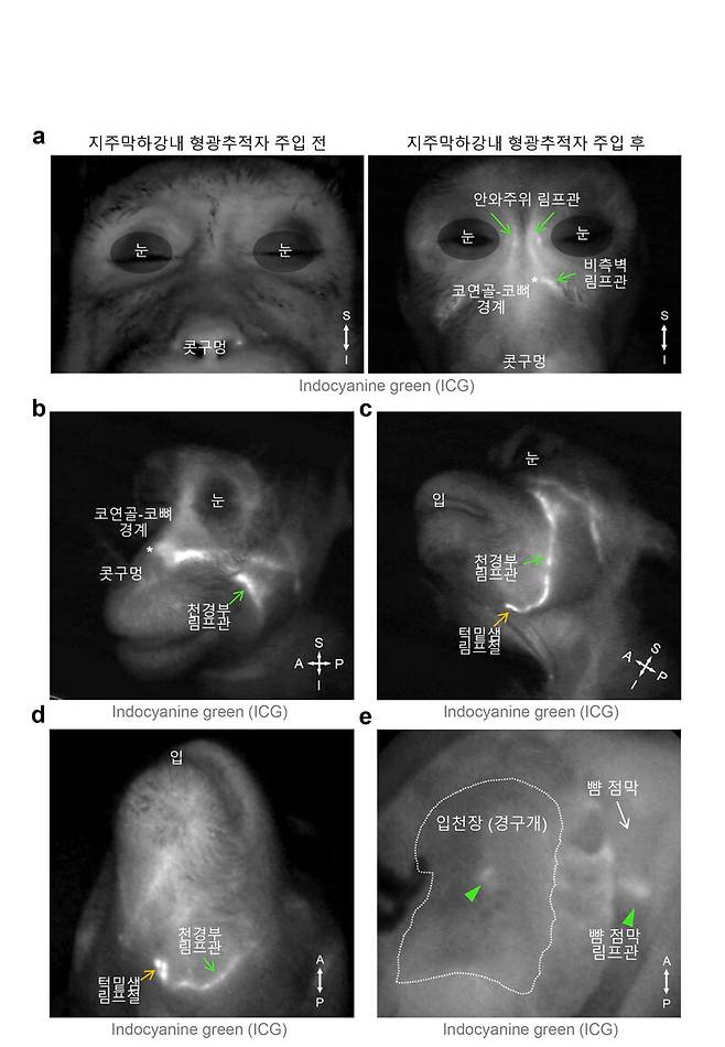 영장류에서 관찰된 뇌척수액 배출 림프관 분포. 지주막하강은 뇌와 척수를 둘러싸고 보호하는 세 개의 뇌막 중 두번째와 세번째 막 사이에 있는 공간을 말한다. 기초과학연구원 제공