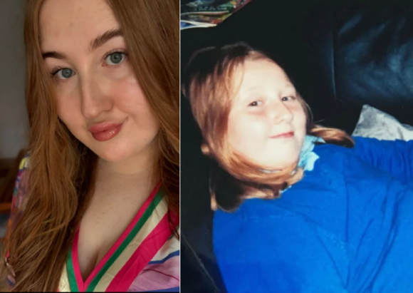 어린시절부터 겪어온 만성 두통을 단순한 감기나 스트레스 때문으로 여기고 방치했다가 결국 시력을 잃은 영국 여성의 사연이 전해졌다. 두통의 원인은 희귀 뇌종양이었다. 니암 로즈 멀헤런 SNS