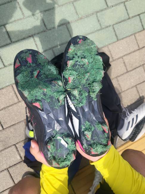 ▲ 축구 일반부 경기에 출전한 선수의 축구화에 충진재가 떡처럼 뭉쳐진 채 떨어지지 않는 모습을 보이고 있다.