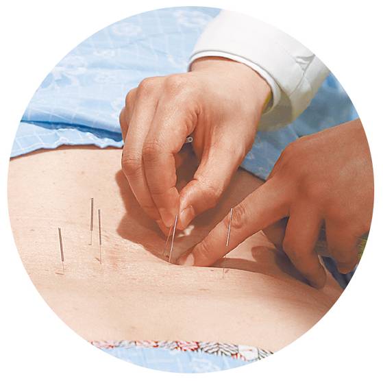 정재중 원장이 환자에게 전기 자극을 첨가한 전침을 하는 모습. 김동하 객원기자