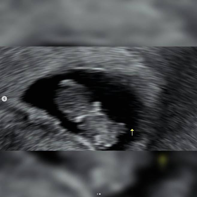 사진=유나 인스타그램