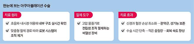 한눈에 보는 아쿠아블레이션 수술