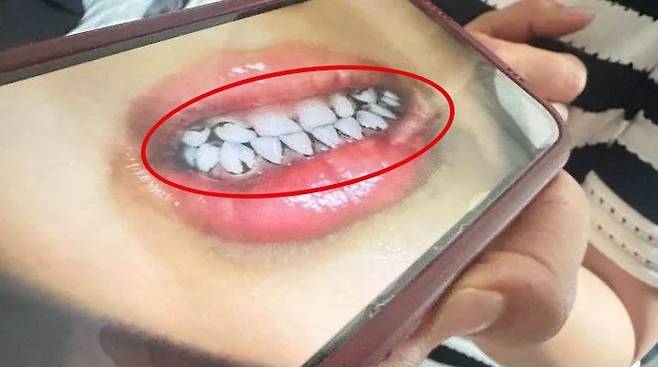 지난 3일 중국 간쑤성에서 발생한 유치원 집단 납중독 사건과 관련해 한 학부모가 현지언론에 공개한 사진. 사진=상유신문(上游新?) 캡처