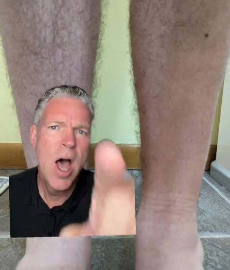 당뇨병성 신경병증으로 인한 탈모에 대해 설명하는 케네스 할리스/사진=케네스 할리스 틱톡 채널 캡처