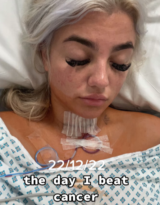 영국에서 한 20세 여성이 극심한 피로 등의 증상을 겪었으나 의사로부터 몇 년간 무시당한 뒤 갑상선암 판정을 받은 사연이 알려지며 경각심을 불러일으키고 있다. 틱톡 캡처