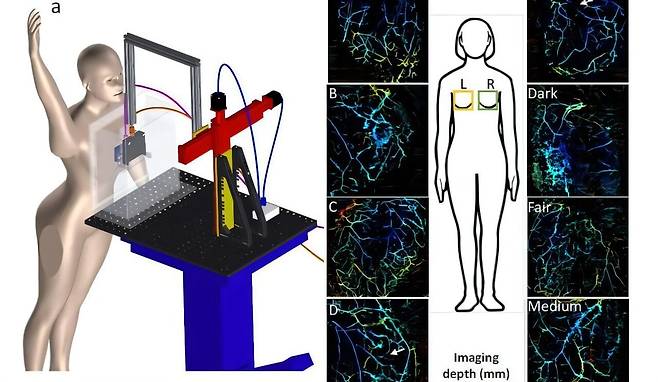 미 뉴욕주립대 버펄로 캠퍼스 연구진이 개발한 원터치-팻 기술은 여성이 선 채로 이미지 창에 몸을 대면 레이저와 초음파 스캔을 1분 안에 진행하는 방식이다./University at Buffalo