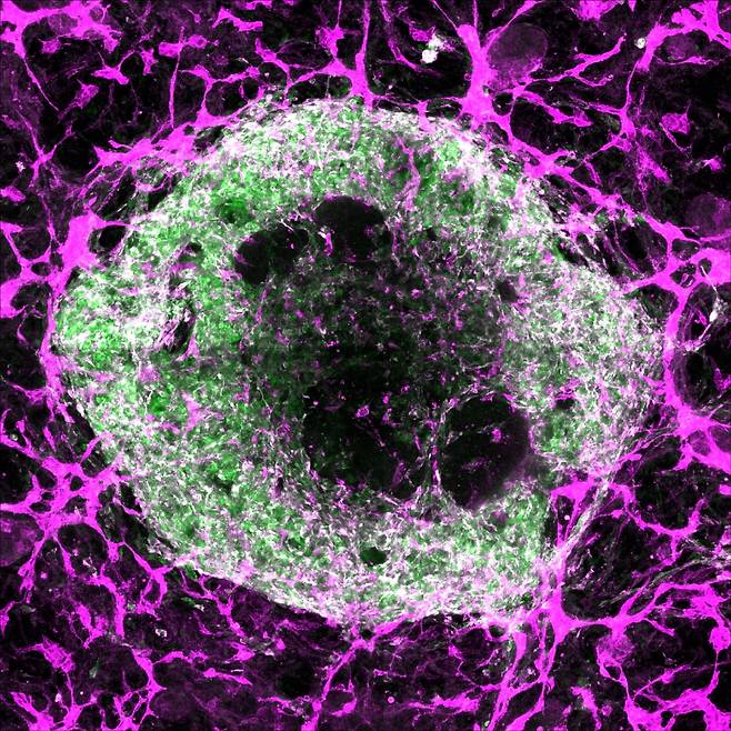심근세포(녹색)와 평활근세포(흰색)로 구성된 2주 된 심장 오가노이드. 혈관을 만드는 내피세포(분홍색)로 둘러싸여 있다./미 스탠퍼드대