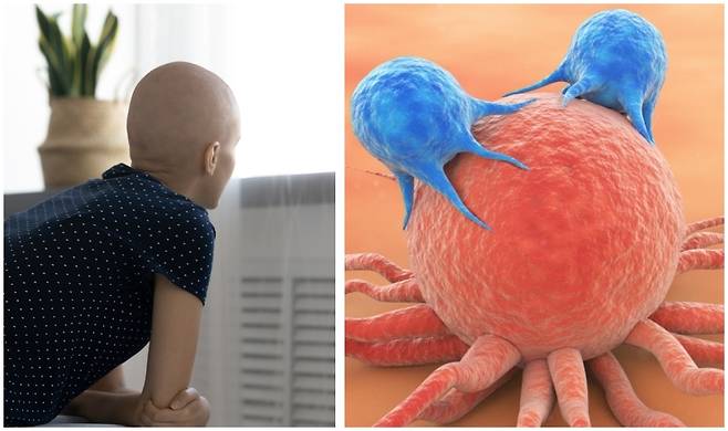 소아백혈병으로 진단받은 10세 미만 환자는 매해 1000~2000명으로 보고되고 있다. 게티이미지뱅크