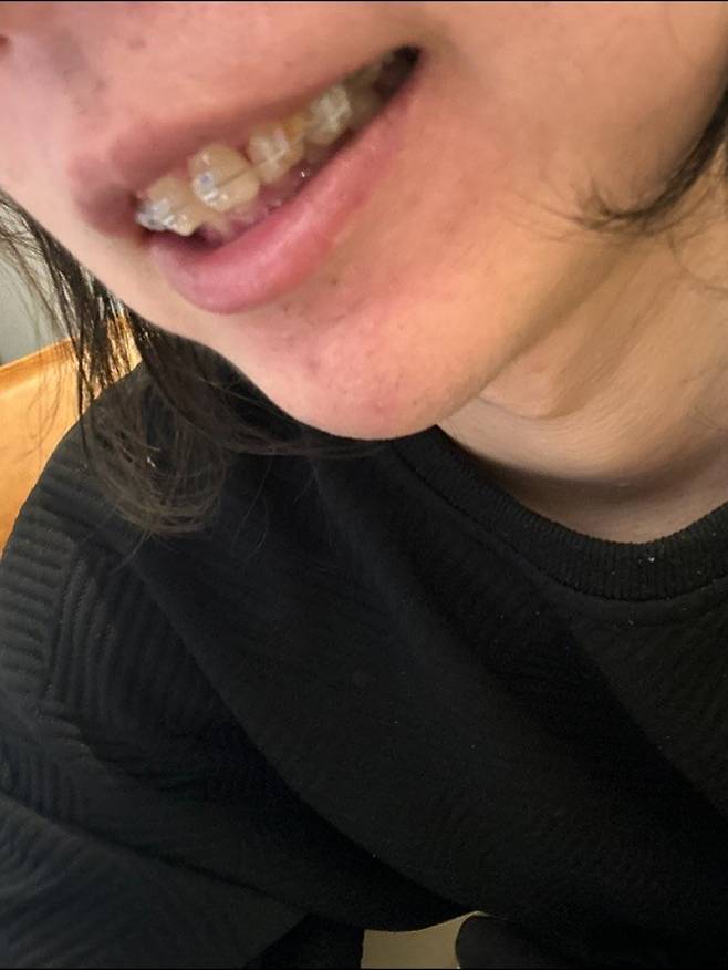 유우키4.jpg 일본 일상 유튜버 \'유우키\' 최근 근황