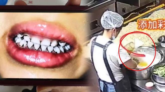 중국서 납중독 의심으로 치아 일부가 검게 변한 유치원생(왼쪽)과 '집단 납중독' 中 유치원 급식 조리 장면(오른쪽) ⓒ 연합뉴스