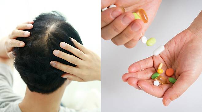 과도한 영양제 섭취가 탈모나 피부 질환, 간 손상 등 치명적인 부작용을 불러올 수 있다는 연구결과가 나왔다. 클립아트코리아 제공