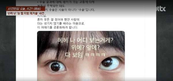 눈 밑 지방 제거 수술을 받은 뒤 한쪽 눈에 사시 증상이 생겼다고 밝힌 한 여성의 사연이 전해졌다./사진=JTBC ‘사건반장’ 캡처
