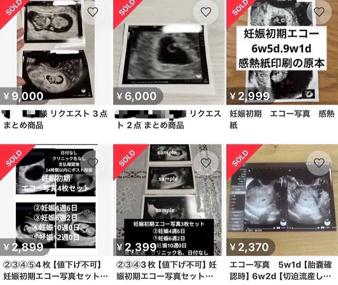 일본의 중고거래 플랫폼 메루카리에 게재된 태아 초음파 거래 자료사진./사진=온라인 SNS(소셜미디어) 화면캡쳐.