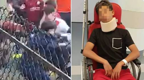 13세 골키퍼 폭행 사건 당시(왼쪽). 골절상을 입은 피해 선수. /사진=토리노 크로나카 갈무리