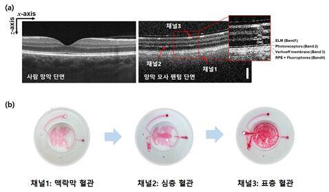 (a) OCT 장비로 촬영한 사람 망막과 팬텀의 단면 영상을 비교해 다층 구조의 유사성을 확인했다. (b) 팬텀의 혈관 네트워크 구조가 실제와 유사하며, 채널별(1: 맥락막, 2: 심층, 3: 표층) 용액 누수가 없음을 검증했다./표준연