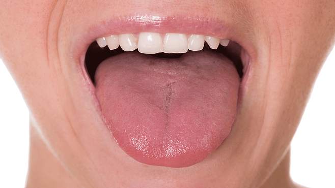 구취 원인의 대부분은 설태를 포함한 구강 내에서 비롯된다. 따라서 양치 시 혀를 함께 닦는 것이 권장된다|출처: 클립아트코리아