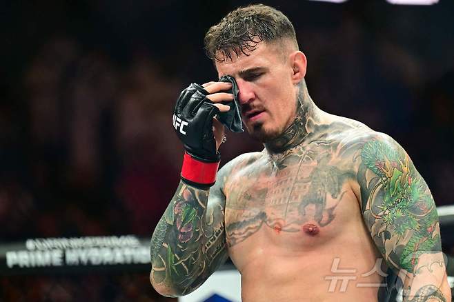 눈을 찔린 후 고통스러워하는 톰 아스피날. ⓒ AFP=뉴스1