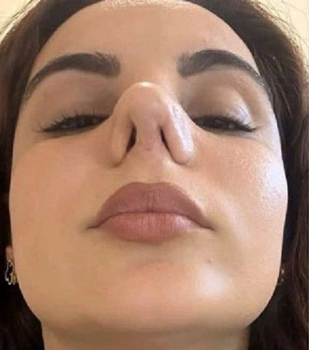 니드투노우 캡처