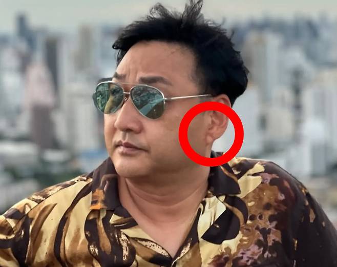 개그맨 김수용이 촬영장에서 의식을 잃고 쓰러져 병원으로 이송된 가운데, 그의 귓불에 있던 대각선 모양 주름이 재조명되고 있다. 귓불 주름은 치매나 심혈관 질환 위험을 알리는 신호로 여겨진다. /사진=김수용 인스타그램 캡