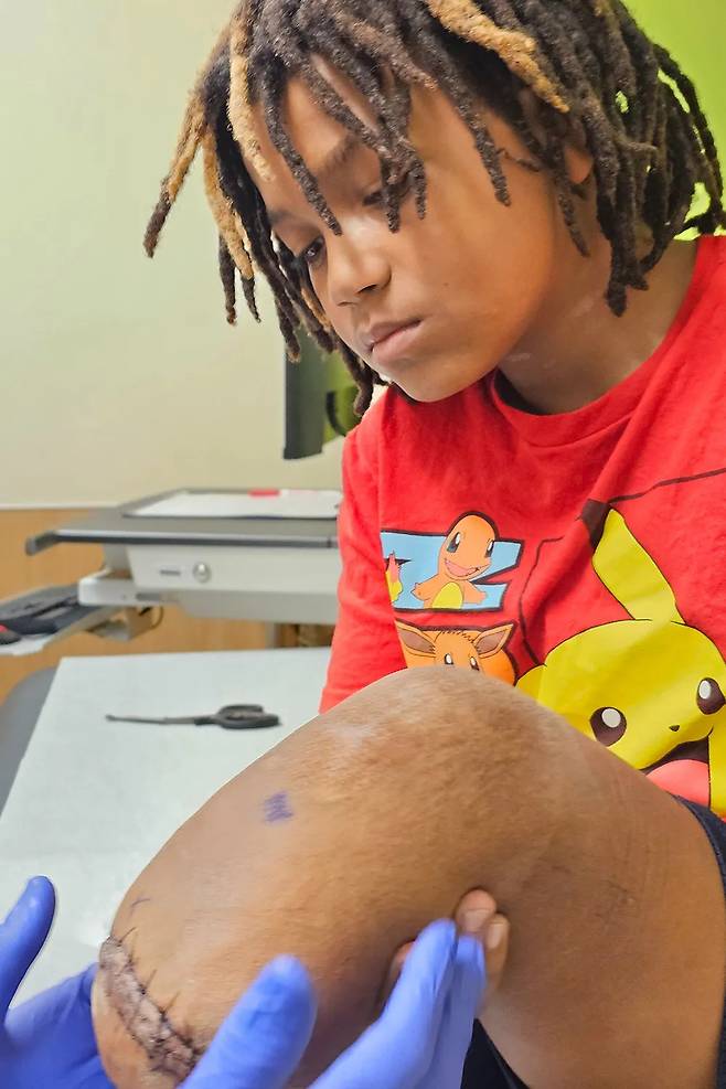 케이튼 스티븐슨