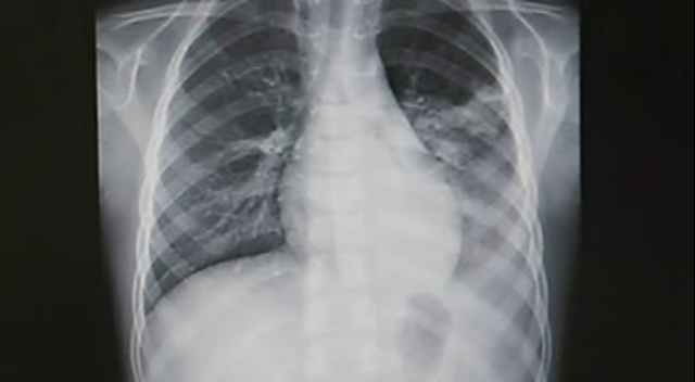 사진은 기사 내용과 무관함. 연합뉴스