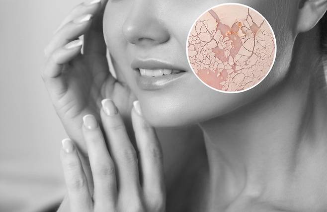 낮은 습도는 피부 노화와 안구건조증을 유발할 수 있어 가습기나 젖은 수건으로 습도를 조절해야 한다. 사진=게티이미지뱅크.