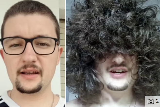 프랭크 일렛의 2024년 10월과 현재 모습500일전 모습. 프랭크 일렛 SNS