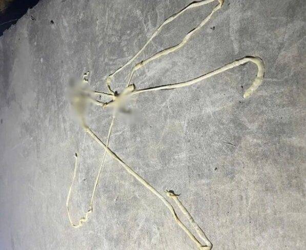 베트남 남성의 몸에서 빠져나온 10m 길이의 돼지촌충. 사진=제트뉴스