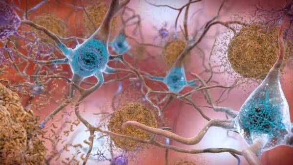 Beta-Amyloid Plaques and Tau in the Brain / NIH, flickr
