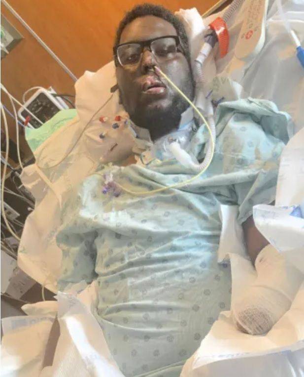 정기 치과 검진 이후 합병증에 걸린 데이본 밴터풀. 출처=더 선