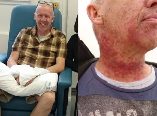 지속적인 인후통을 겪은 60대 남성이 암 진단을 받은 사연이 공개됐다./사진=더 선