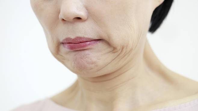 안면거상, 목거상 수술은 함께 진행하는 경우가 많다|출처: 클립아트코리아