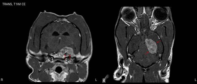 중추신경계이상 MRI 사진