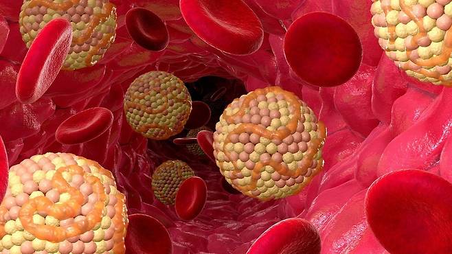 고지혈증 약물은 심뇌혈관 질환을 예방하는 효과가 큰 것으로 알려져 있다|출처: 클립아트코리아
