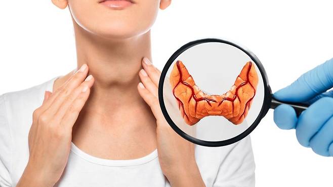 갑상선암은 수술 후 후유증이 생길 수 있으며, 전절제술 시 호르몬제 복용이 필요하다|출처: 클립아트코리아